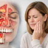 Can Sinusitis Cause Tooth Pain?
