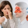 Can Sinusitis Happen After a Cold? What to Know
