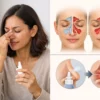 Decongestant Spray Rebound Congestion Explained