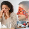Sinus Congestion: Causes, Relief and Red Flags