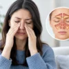 Examples of Viral Sinusitis Symptoms to Watch