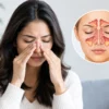 Sinusitis Symptom Checklist and When to Seek Advice