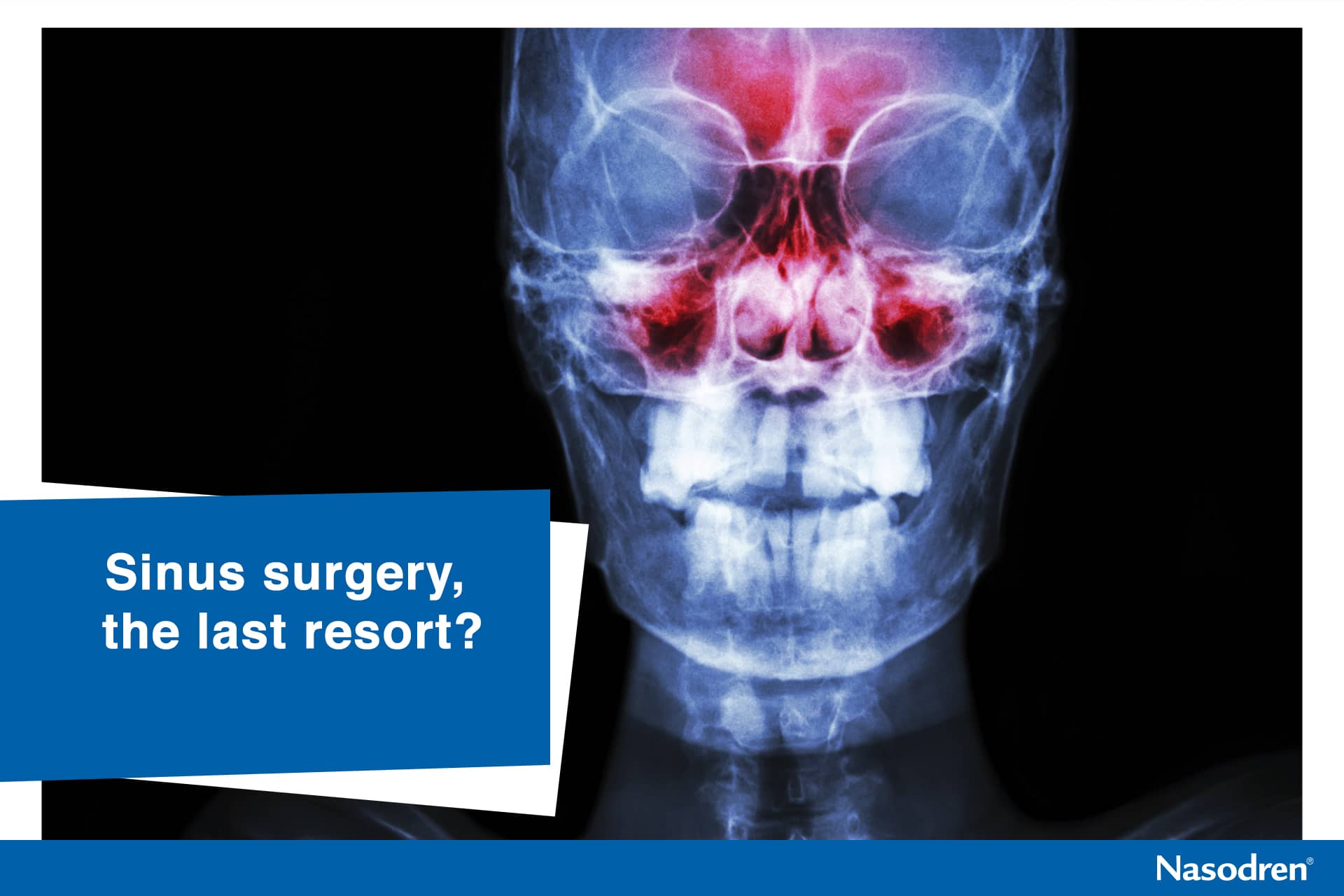 Sinus surgery