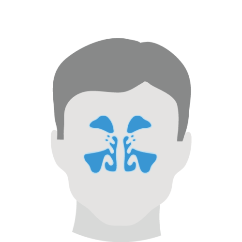 Nasodren® - Natural Treatment for Sinus Infection Symptoms