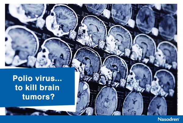 Polio virus... to kill brain tumors?