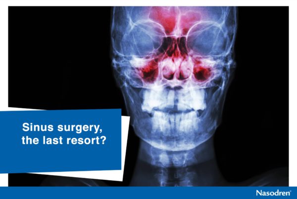 Sinus surgery