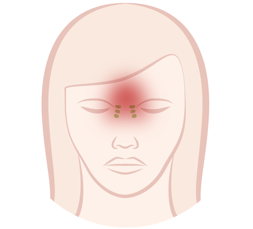 Ethmoid sinuses