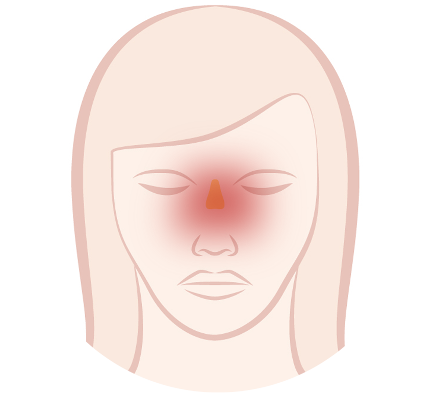 Sphenoid sinuses