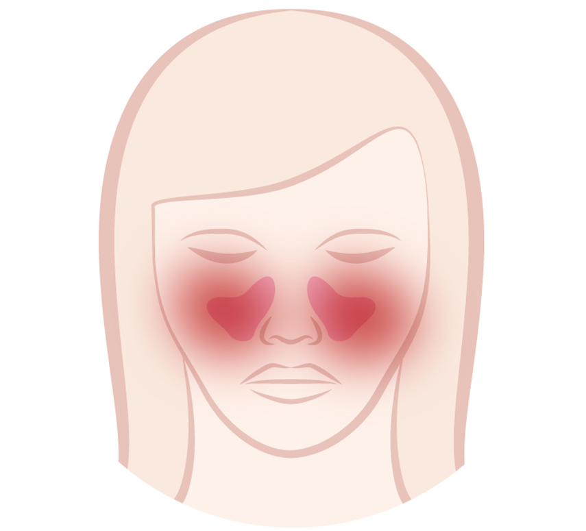 Maxillary sinuses